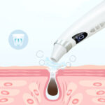 Electric Visual Blackhead Suction Instrument Household Cleansing Pore Cleaner For Skin Equipment Skin Care Tool - Image 4