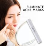 Blue Light Therapy Acne Laser Pen Soft Scar Wrinkle Removal Treatment Device Skin Care Beauty Equipment - Image 7